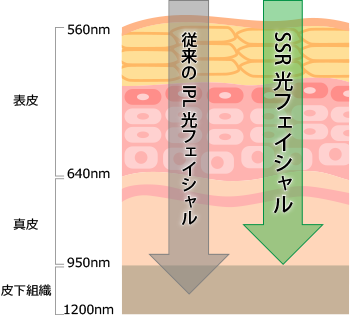 図：従来のIPL光フェイシャルとSSR式光フェイシャル